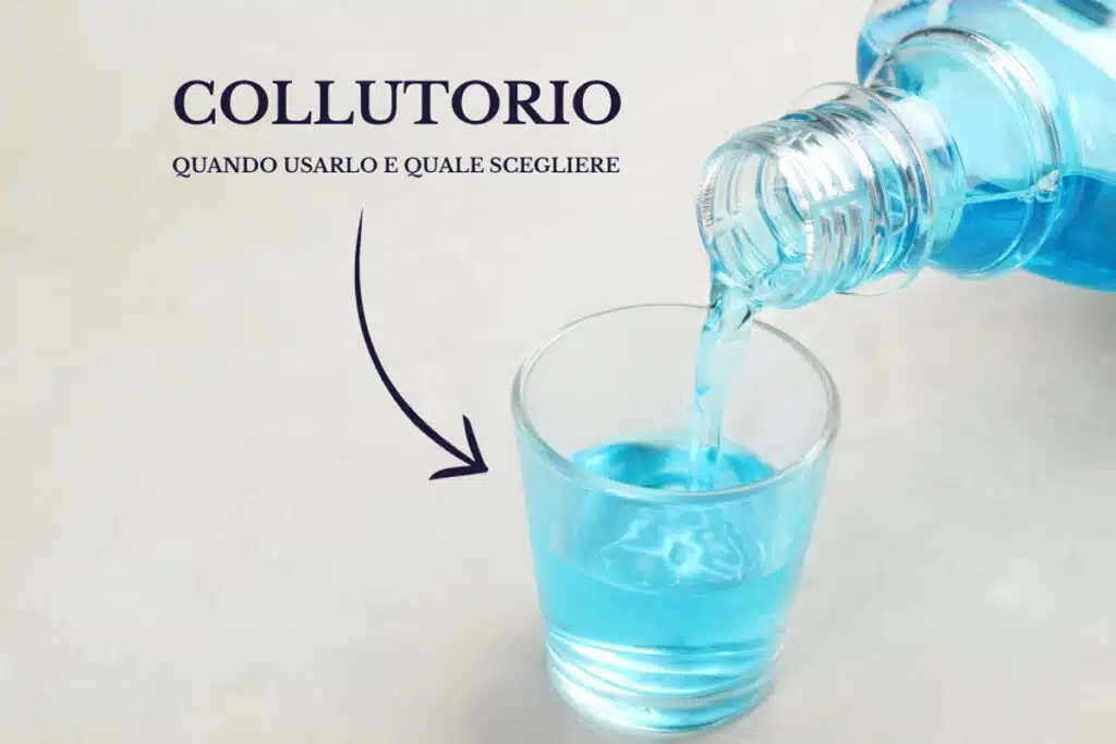 Collutorio: quando usarlo e quale scegliere