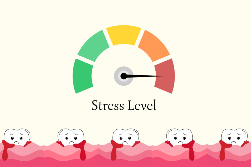 Stress e salute orale: come ansia e tensione influenzano denti e gengive
