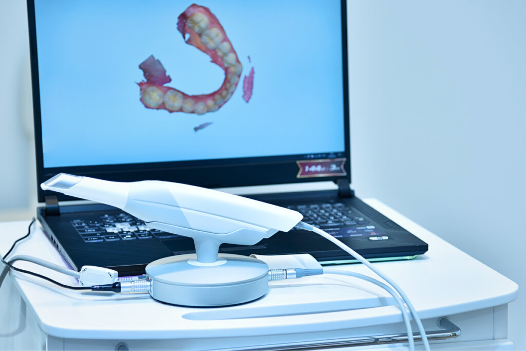 Scanner intraorale: addio alle impronte tradizionali