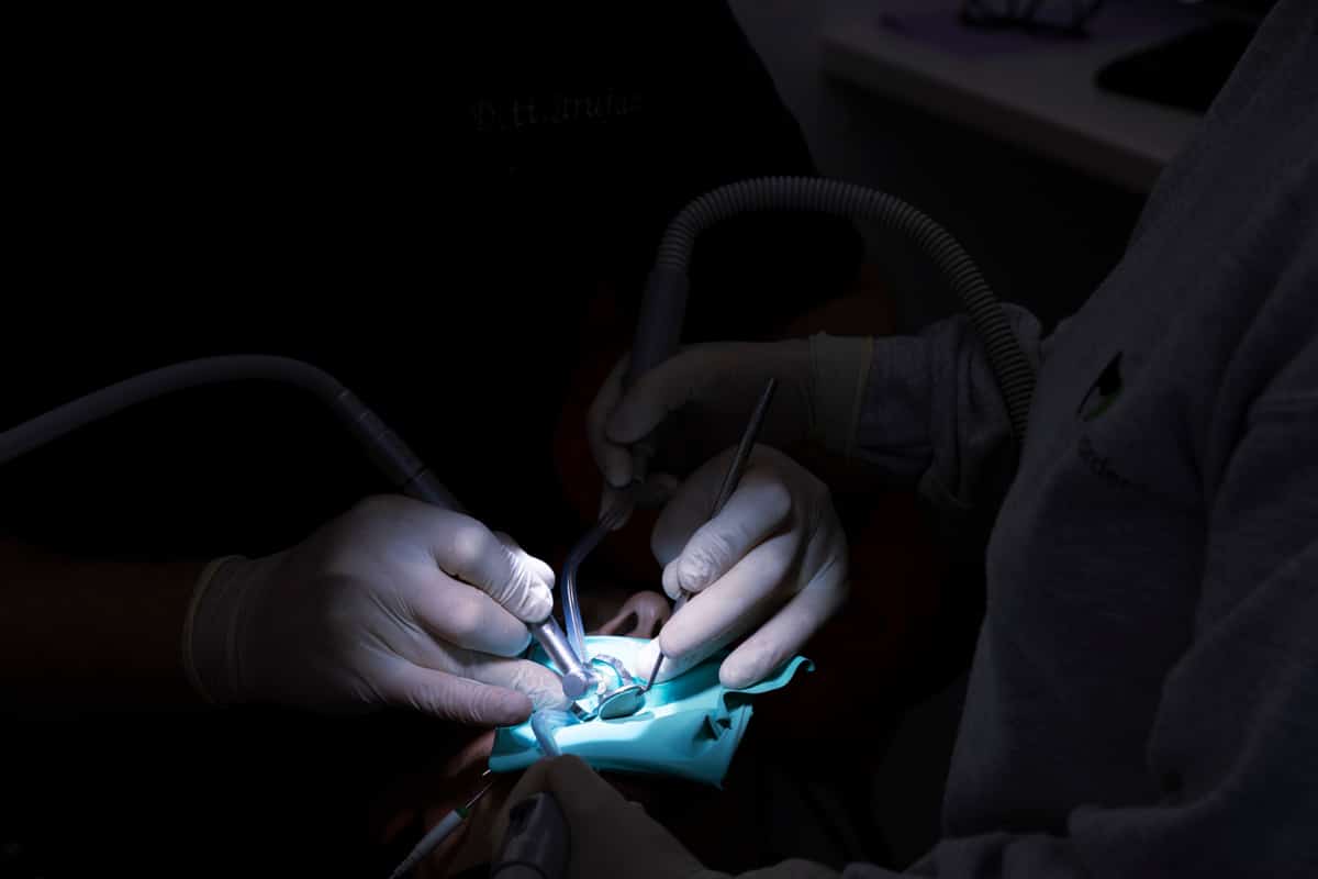 Cosa succede davvero durante un intervento odontoiatrico